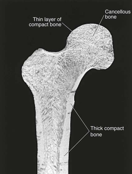 Spongy bone and compact bone. Structure and Function of Joints | Musculoskeletal Key