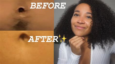 How I Remove Hair From My Stomach No Shaving Or Waxing Youtube