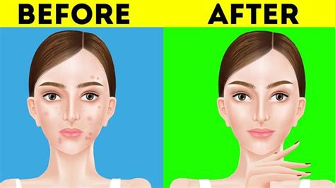 Just Use 3 Natural Remedies To Get The Most Beautiful Clear Skin Of Your Clear Skin
