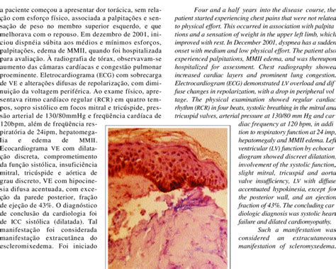 Histopathologic Examination Revealing Mucine Deposits On The Papill A