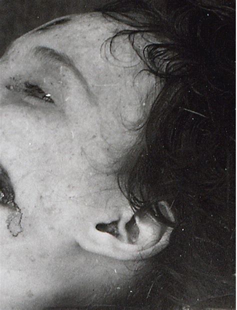 Black Dahlia Crime Scene Photos And Forensics Part Ii