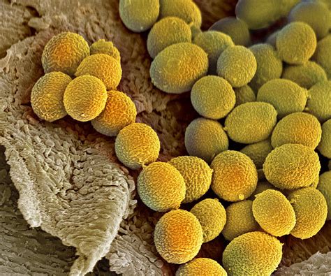 Fungal Spores Sem Photograph By Steve Gschmeissner Fine Art America