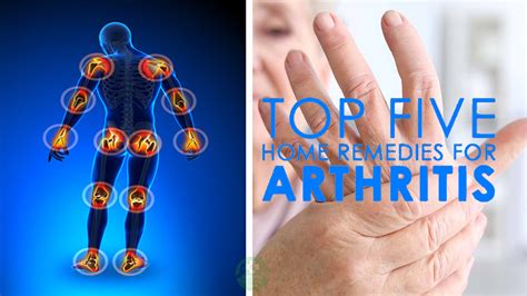 5 Natural Remedies For Arthritis Top Natural Remedy