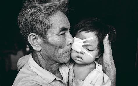 Eliminating Childhood Blindness In Vietnam Fred Hollows Fred