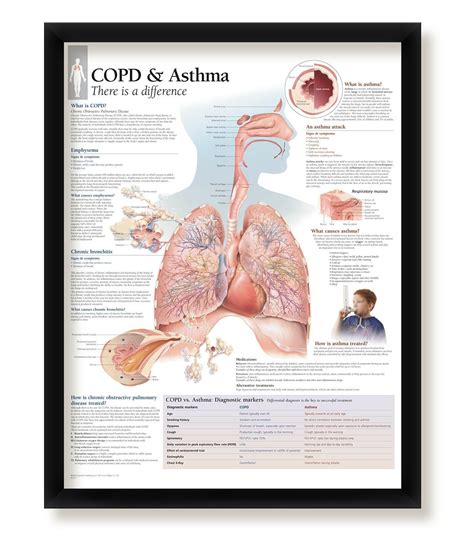 3 Medical Posters Understanding Asthma COPD And COPD Asthma Wall