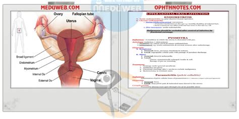 Endometritis Pyometra And Parametritis Causes And Treatment Meduweb