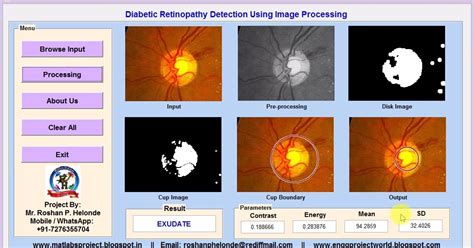 Matlab Code Diabetic Retinopathy Detection Using Image Processing Full