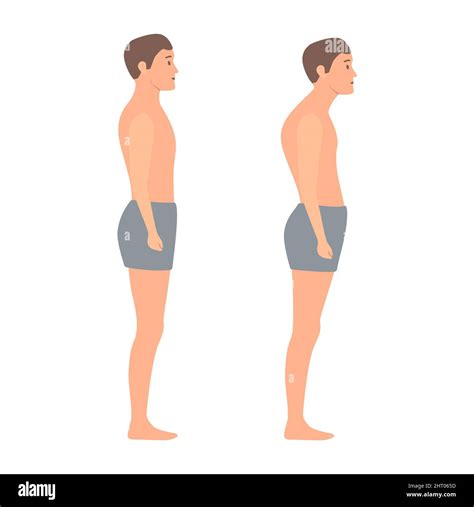 Bad Standing Posture