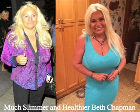 Beth Chapman Boobs Reduction Plastic Surgery Rumors