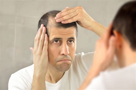 What Can Cause Hair Loss Vera Clinic