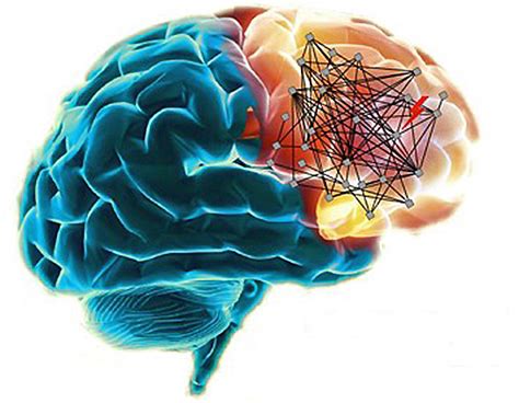 Mutated Genes In Schizophrenia Map To Brain Networks National