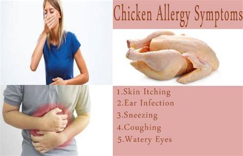 Chicken Allergy Definition Symptoms Risk Factors And More