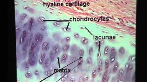Hyaline Cartilage Hyaline Cartilage Anatomy And Physiology Medical
