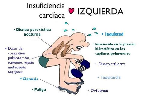 Resultado De Imagen De Insuficiencia Cardiaca Mnemotecnia Nursing