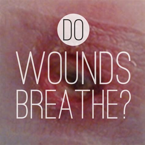 The Battle Of Wound Healing Dry Vs Moist Wcei Blog Wcei Blog