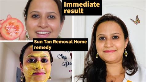 How To Remove Sun Tan From Your Face Quickly Suntan Tipsbeauty