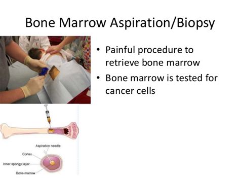 It can be debilitating, especially when recognized too late. Pediatric Term Review