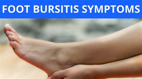 Foot Bursitis Symptoms Youtube