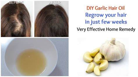 The Benefits Of Garlic For Hair Health Benefits