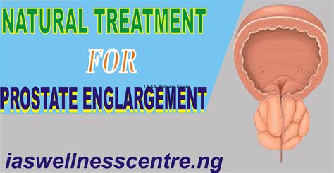 Natural Treatment For Prostate Enlargement In Nigeria Ias Wellness