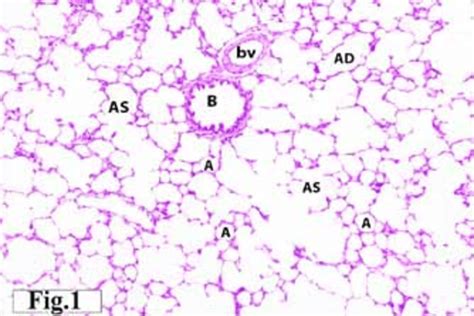 Alveolar Duct And Sac Histology