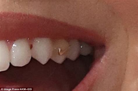 Katy Perry Shows Off Her Gold Nike Tooth Jewelry Daily Mail Online