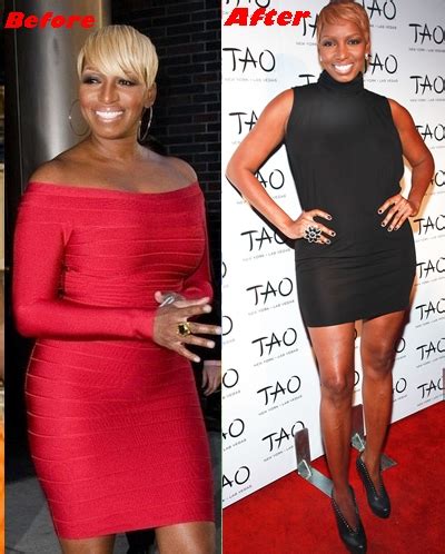 NeNe Leakes Breast Reduction Surgery Before And After Boobs Job Photos Plastic Surgery