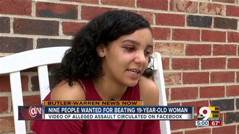 Victim Of Alleged Assault Talks About Beating Youtube