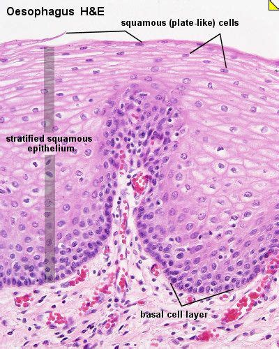 Stratified Squamous Epithelium Tissue Stratified Squamous Epithelium