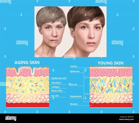 The Diagram Of Younger Skin And Aging Skin Showing The Decrease In