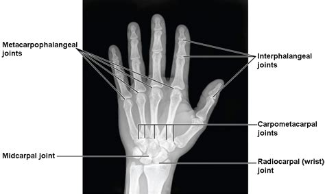 Bones Of The Upper Limb Anatomy And Physiology I