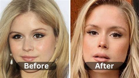 Erin Moriarty Plastic Surgery Before After Myth Or Reality Weight Loss