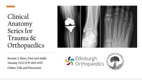 Clinical Anatomy Series For Trauma And Orthopaedics Knee Foot And
