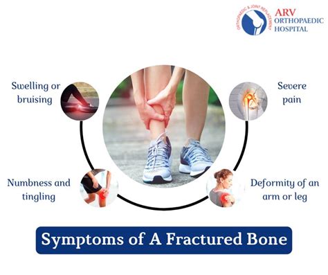 Symptoms Of A Fractured Bone In 2021 Orthopedics Bone Specialist
