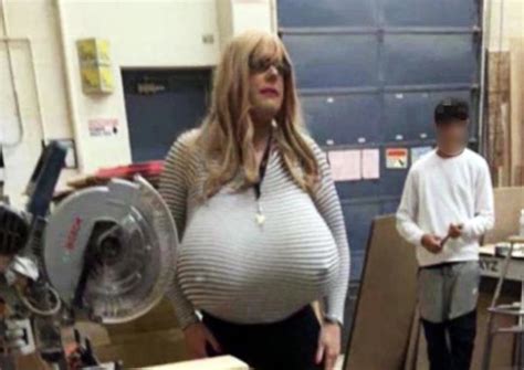 Oakville Teacher Allowed To Continue Wearing Large Prosthetic Breasts
