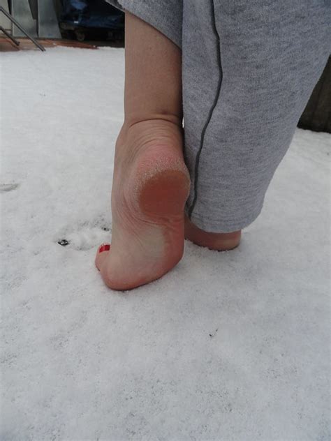 Barefoot In The Snow 1 Flickr Photo Sharing