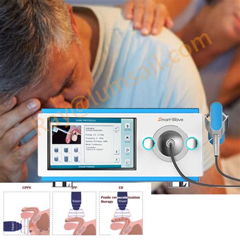 Gainswave Eswt Low Intensity Shockwave Therapy For Erectile Dysfunction