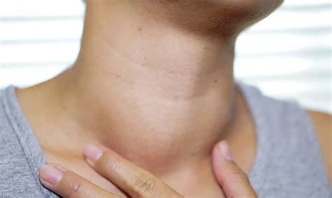 Nodule On Thyroid Size