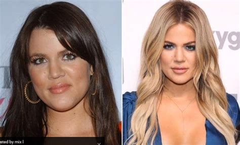 Has Khloe Kardashian Gone For Plastic Surgery