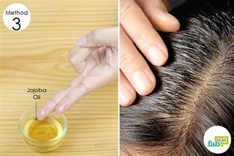 8 Best Home Remedies For Dry Flaky Scalp That Work Fab How