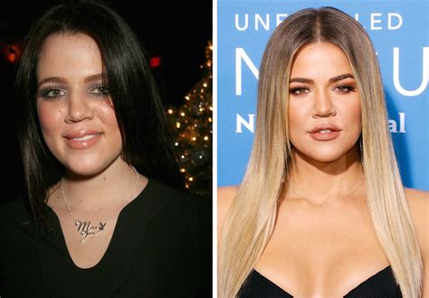 Kardashian Sisters: Who's Gotten the Most Surgery?