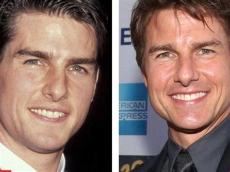 Tom Cruise Teeth Before And After When Did The Actor Fix His Teeth Firstcuriosity