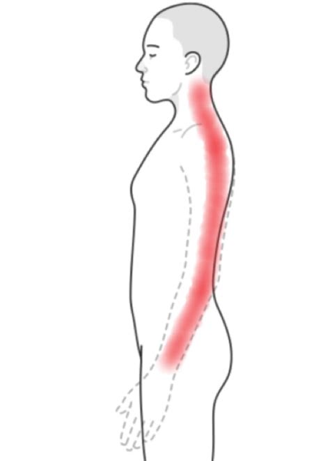Neck And Arm Pain Relief