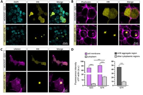 Co Localization Of F Actin With MHtt Aggregates In HEK293T Cells A