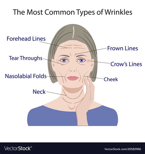 Common Types Facial Wrinkles Cosmetic Surgery Vector Image