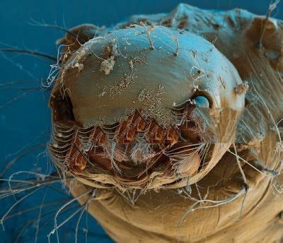 Over time, their appearance may change, in terms of colour. Mosquito Larva under Electron Microscope | I fucking love ...