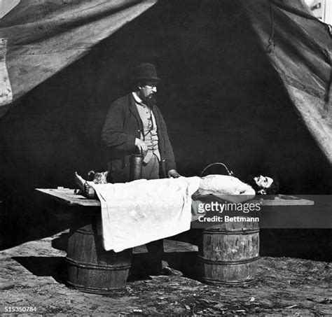 Embalming Surgeon At Work On A Civil War Soldiers Body The Corpse