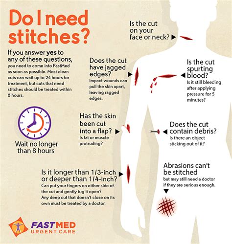 When Do You Need Stitches Renew Physical Therapy