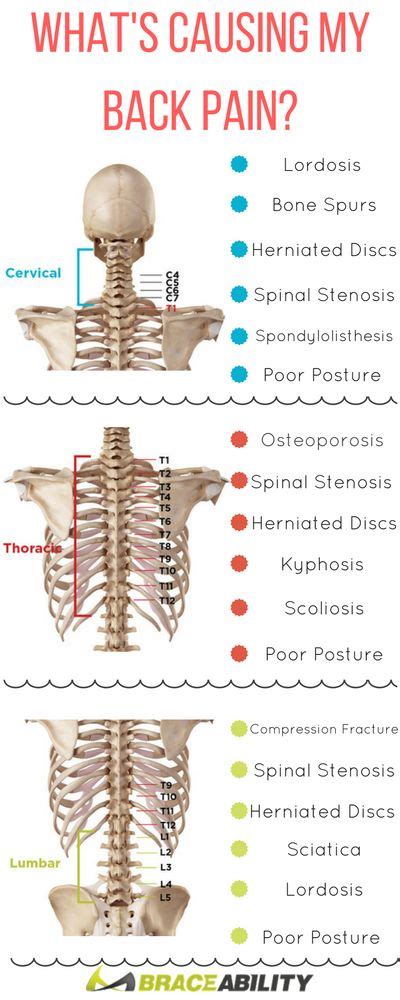 Left side lower back pain may be caused by strain, injury or serious underlying diseases like kidney stones and tumor. 1000+ images about Chiropractic School on Pinterest ...
