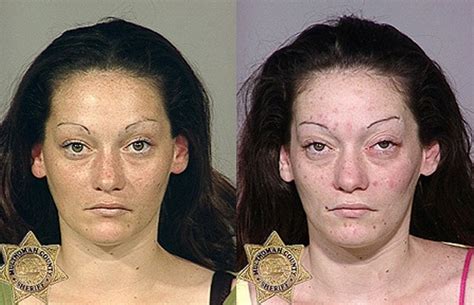 From Drugs To Mugs Shocking Before And After Images Show The Cost Of Drug Addiction